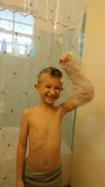 waterproof cast cover evan ballantyne image